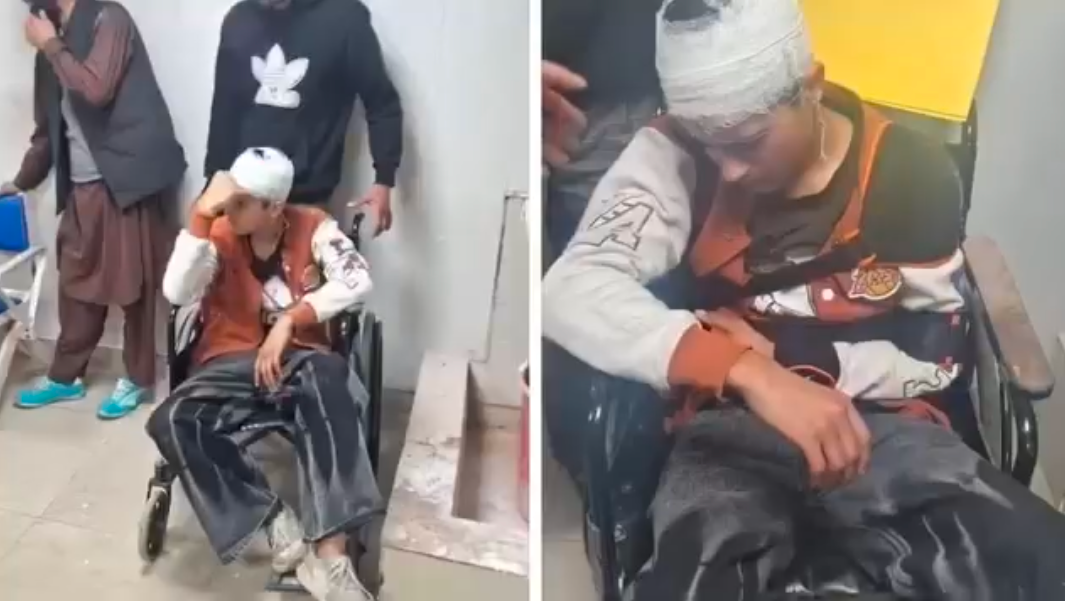 दुकानदार द्वारा दो कश्मीरी युवकों से मारपीट, एक घायल; हिरासत में आरोपी